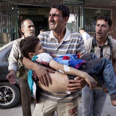 Amnesty anklagar Ryssland för att ha dödats hundraals civila. En far bär sin skadade son utanför ett sjukhus i Aleppo
