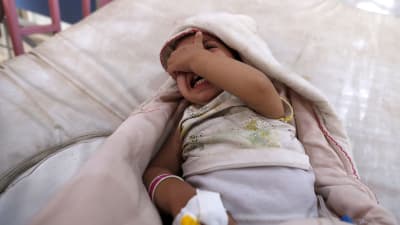 Barn som insjuknat i kolera i Jemen.