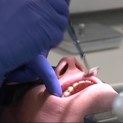 hammas hammaslääkäri suu suojakäsineet