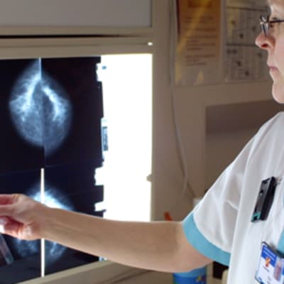 Sairaanhoitaja tutkii röntgenkuvia