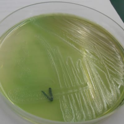 bakterier, pseudomonas aeruginosa
