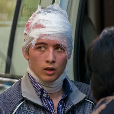 En man med blodigt huvdbandage efter slagsmålen mellan proryska demonstranter och "Single Ukraina"