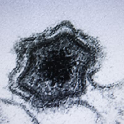 Sikaruttovirus mikroskooppikuvassa.