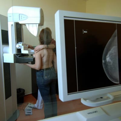 Mammografiundersökning i Berlin 2007