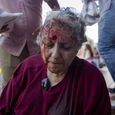 Ana Quiroz, aktivist i nätverket Kvinnor mot våld, blöder i samband med de första gatuprotesterna på onsdagen. 