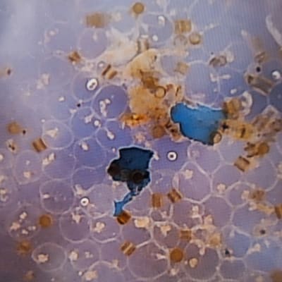 Mikroplaster omringade av plankton i ett mikroskop.