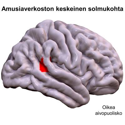 Mallinnus aivoista joihin keskelle on merkitty sävelkorvattomuuden eli amusian sijainti.