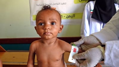 Ett barn i Jemen får armens omkrets mätt 5.6.2021