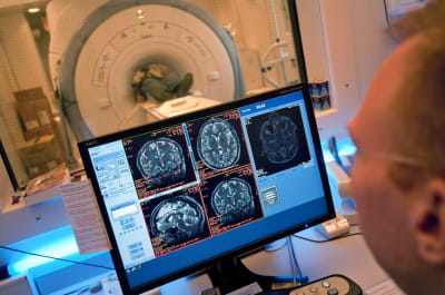 Läkare följer med patientens hjärna under datortomografin.