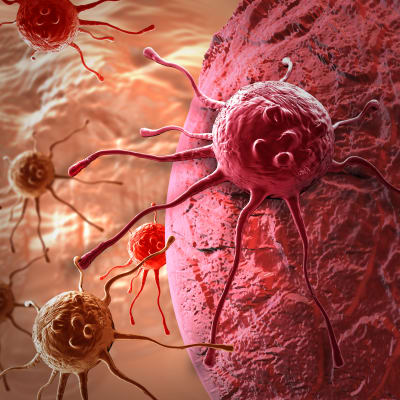 En animerad bild av en cancercell som landat på någon annan cell i kroppen.