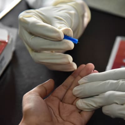 Tre händer syns på bilden: två med handskar på tar ett blodprov med ett prick i fingerspetsen på den tredje, icke-handskbeklädda handen.