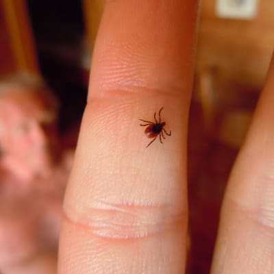 fästing på ett finger