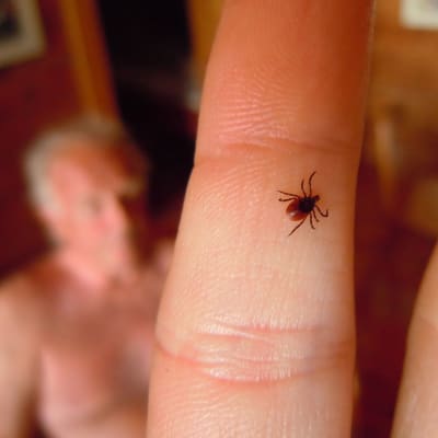 fästing på ett finger