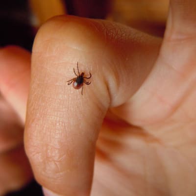 Fästing som kryper på finger.
