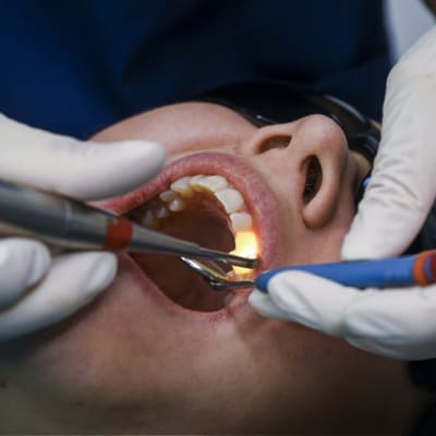 tandläkare undersöker mun