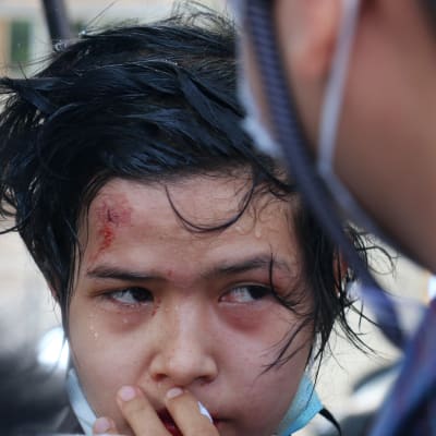 En ung demonstrant med ett sår i pannan 