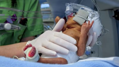 En sköterska tar hand om en för tidigt född baby.