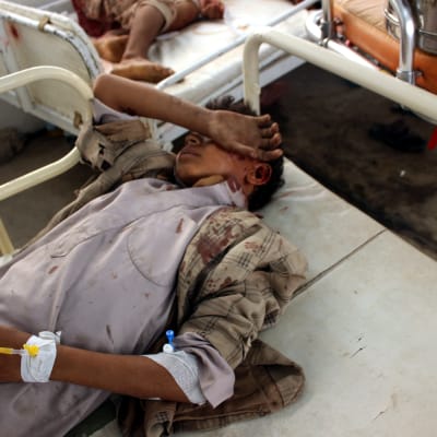 Skadade barn på Röda korsets sjukhus i Saada i norra Jemen