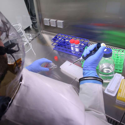 Ebola behandlas i ett laboratorium i Tyskland