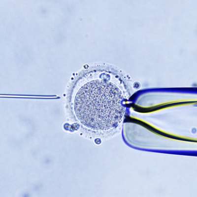 Mikroskopbild av IVF-behandling: en spermie sprutas in i en äggcell.