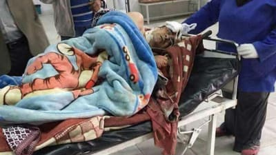 Person som skadades i en islamistattack mot en moské på Sinaihalvön i Egypten i november 2017