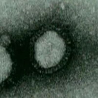 Viruset sett genom ett mikroskop