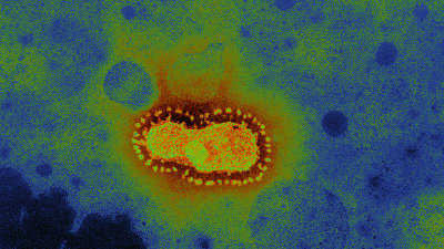 Coronavirus i ett mikroskop.