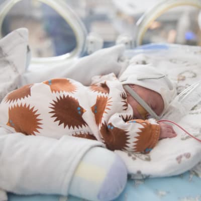 En prematurbebis får intensivvård i en kuvös.
