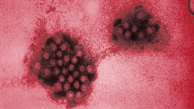 Förstorad blid av Norwalkviruset, även kallat norovirus.
