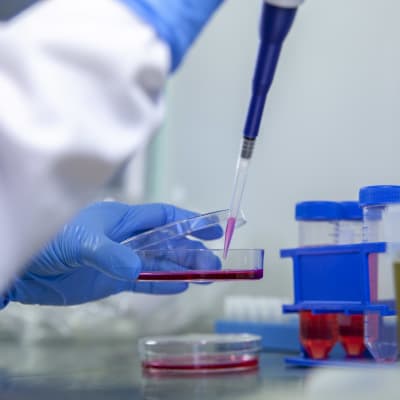 En hand i en blå skyddshandske håller i en petriskål med röd vätska i ett laboratorium. Ur burken tas lite röd vätska med en pipett.