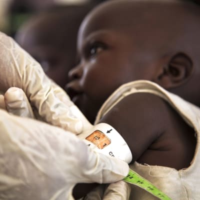En sju månader gammal pojke undersöks vid en Unicef-klinik i Maiduguri 8.12.2016