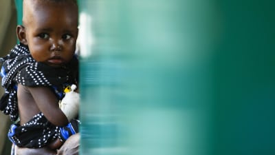 En gutt får behandling på et sykehus i Somalias hovedstad, Mogadishu.