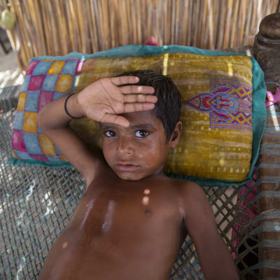 En liten pojke ligger på en bädd och håller ena armen över pannan.
