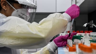 Covid-19-vaccinstudier i laboratorium i Hollywood, Florida 13.8.2020.