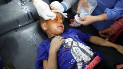 ett barn som skadats i en turkisk flygräd får vård på ett sjukhus i staden Tal Tamr