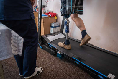 En patient med benprotes går på en joggningsmaskin. 
