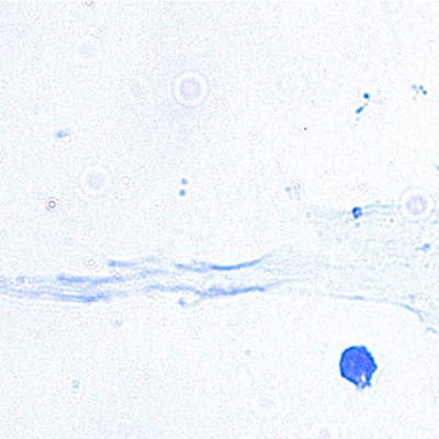 Kuvassa näkyy spermasolu, joka on saatu aikaan alkion kantasoluista.