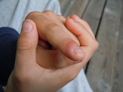 Nageltrång på ett pekfinger.