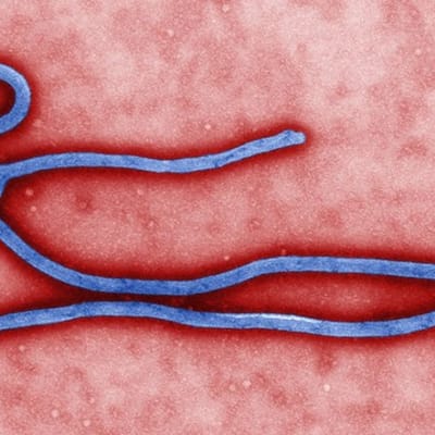 Ebolavirus
