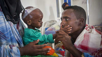 15 månader gamla Abdifatax har hämtats till sjukhus av sina föräldrar.