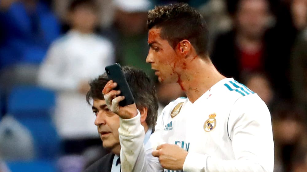 Blodig Ronaldo speglade sig i mobiltelefonen – efter att ha nickat in Reals  sjätte mål – Sport – svenska.yle.fi