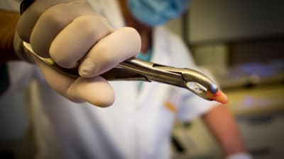 En tandläkare håller fram en tång med en blodig tand i