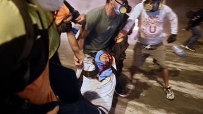 En demonstrant som stöder president Martin Vizcarra får hjälp efter att ha skadats av kravallpolis under en demonstration mot interimspresidenten Manuel Merino 14.11.2020