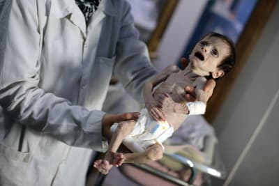 Svältande barn i Ghouta i Syrien.