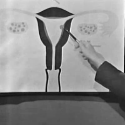 Tecknad bild av livmoder, Yle 1967