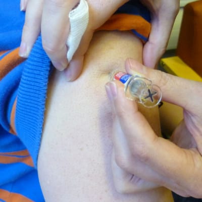 Kausi-influenssarokotetta pistetään käsivarteen