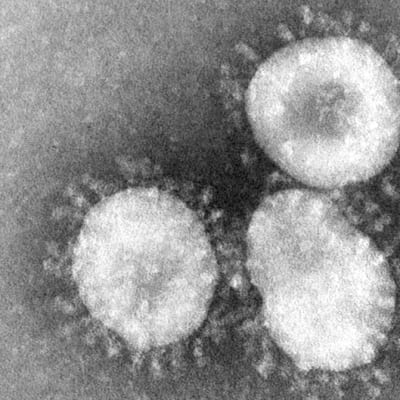 Mikroskooppikuva koronaviruksesta.