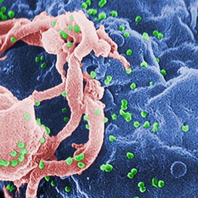 Hivviruset