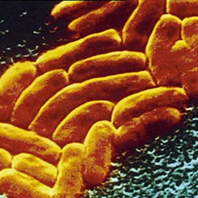 Mikroskooppikuva antibiooteille vastustuskykyisestä sairaalabakteerista.