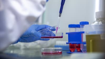 En hand i en blå skyddshandske håller i en petriskål med röd vätska i ett laboratorium. Ur burken tas lite röd vätska med en pipett.